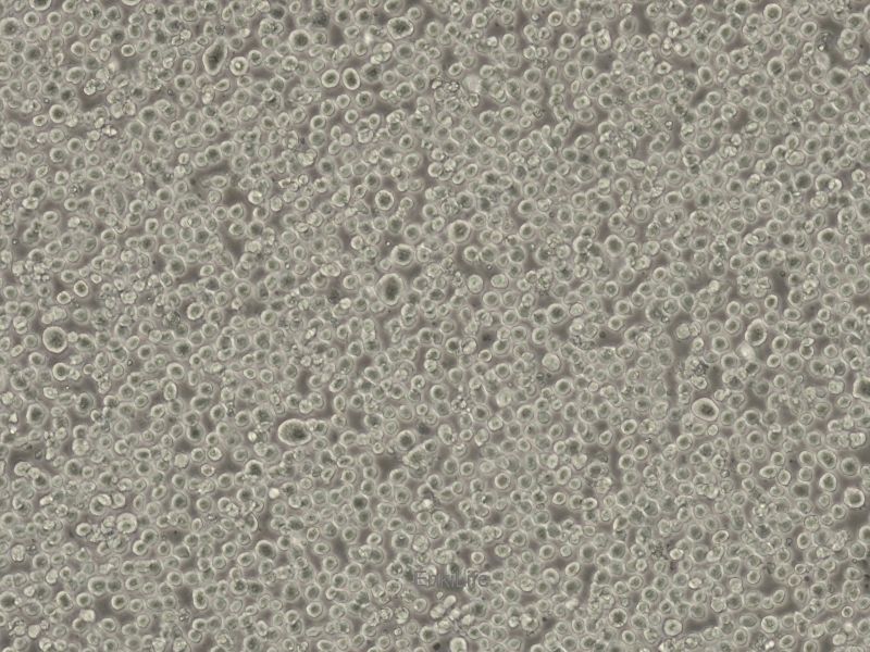 人间变性大细胞淋巴瘤细胞Karpas-299(STR鉴定) | EnkiLife恩玑生命