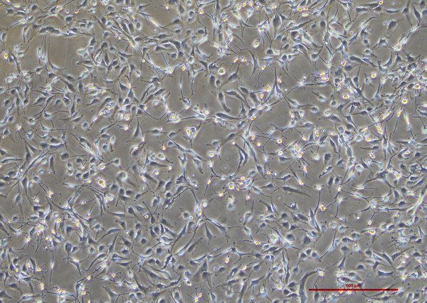 人胶质母细胞瘤细胞A172(STR鉴定) | EnkiLife恩玑生命