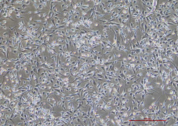 人胶质母细胞瘤细胞A172(STR鉴定) | EnkiLife恩玑生命