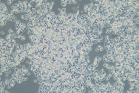 人结肠癌细胞CW2(STR鉴定) | EnkiLife恩玑生命