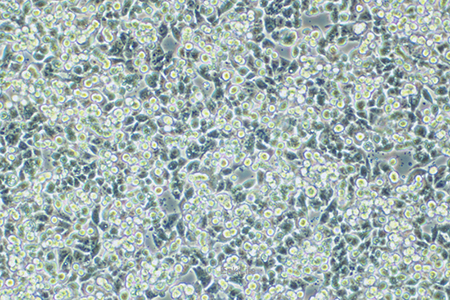 人结肠癌细胞CW2(STR鉴定) | EnkiLife恩玑生命