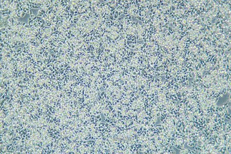 人结肠癌细胞CW2(STR鉴定) | EnkiLife恩玑生命