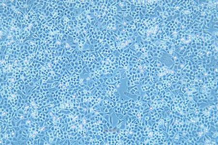 人结肠癌细胞HCT-15(STR鉴定) | EnkiLife恩玑生命