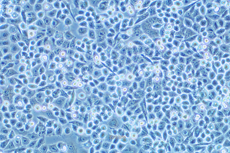 人结肠癌细胞HCT-15(STR鉴定) | EnkiLife恩玑生命