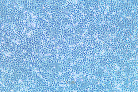 人结肠癌细胞HCT-15(STR鉴定) | EnkiLife恩玑生命