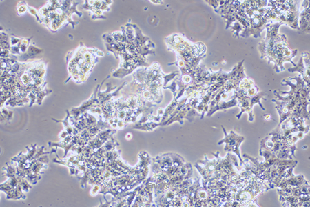 人结肠腺癌细胞LS1034(STR鉴定) | EnkiLife恩玑生命