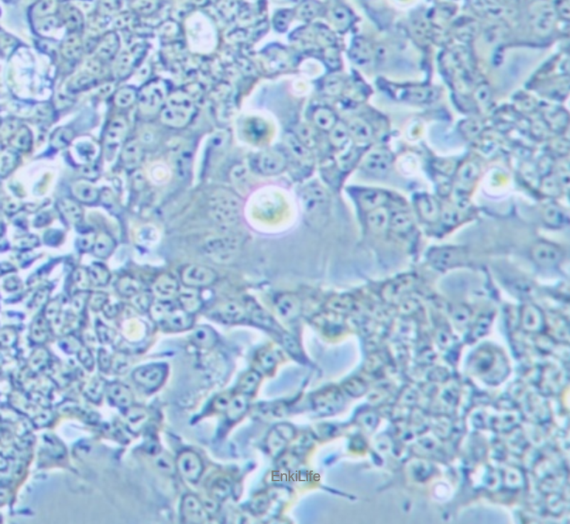 人结肠腺癌细胞SNU-81（STR鉴定） | EnkiLife恩玑生命