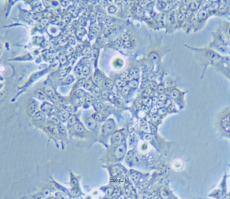 人结肠腺癌细胞SNU-81（STR鉴定） | EnkiLife恩玑生命