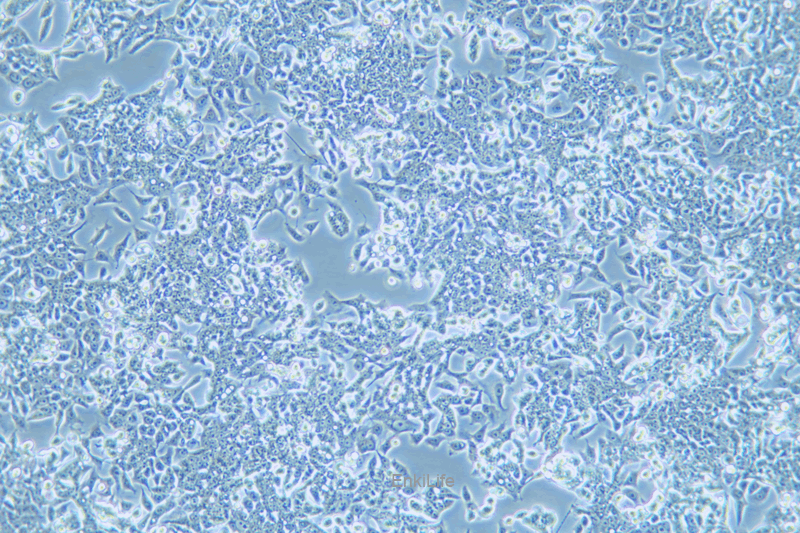 人结直肠癌细胞/氟尿嘧啶耐药株LOVO/5-FU(STR鉴定) | EnkiLife恩玑生命