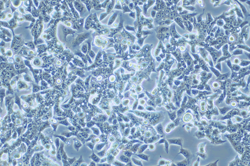 人结直肠癌细胞/氟尿嘧啶耐药株LOVO/5-FU(STR鉴定) | EnkiLife恩玑生命