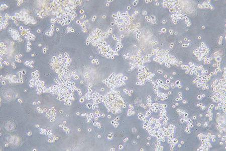 人结直肠腺癌细胞COLO320(STR鉴定) | EnkiLife恩玑生命