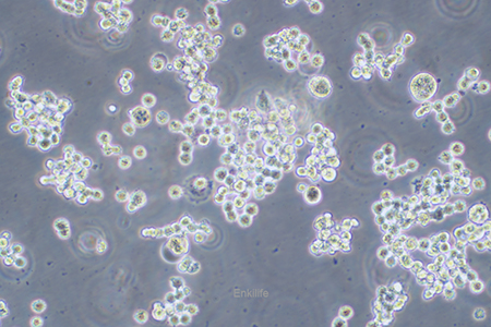 人结直肠腺癌细胞COLO320(STR鉴定) | EnkiLife恩玑生命