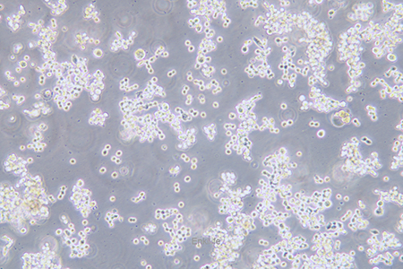 人结直肠腺癌细胞COLO320(STR鉴定) | EnkiLife恩玑生命