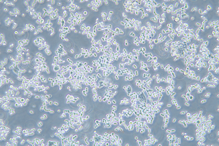 人结直肠腺癌细胞COLO320 DM(STR鉴定) | EnkiLife恩玑生命