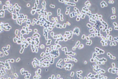 人结直肠腺癌细胞COLO320 DM(STR鉴定) | EnkiLife恩玑生命
