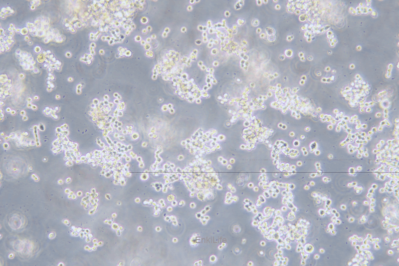 人结直肠腺癌细胞COLO320HSR(STR鉴定) | EnkiLife恩玑生命