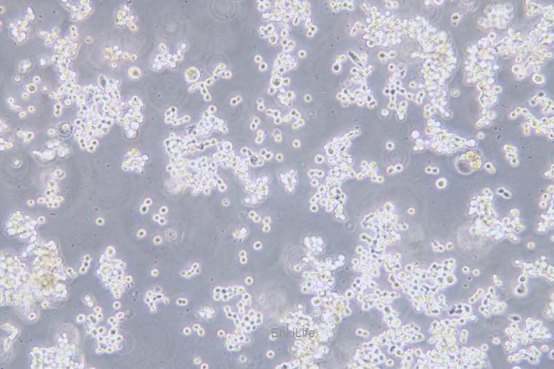 人结直肠腺癌细胞COLO320HSR(STR鉴定) | EnkiLife恩玑生命