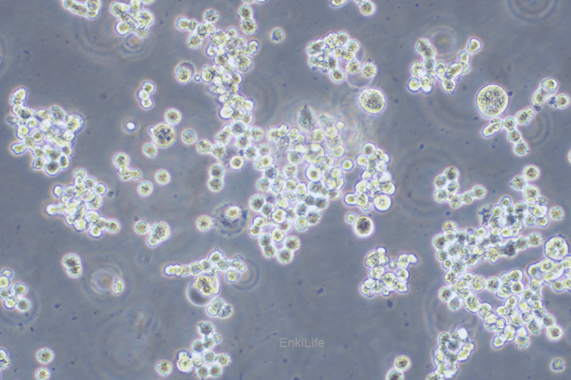 人结直肠腺癌细胞COLO320HSR(STR鉴定) | EnkiLife恩玑生命