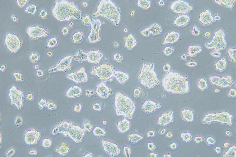 人经典小细胞肺癌细胞NCI-H1688(STR鉴定) | EnkiLife恩玑生命