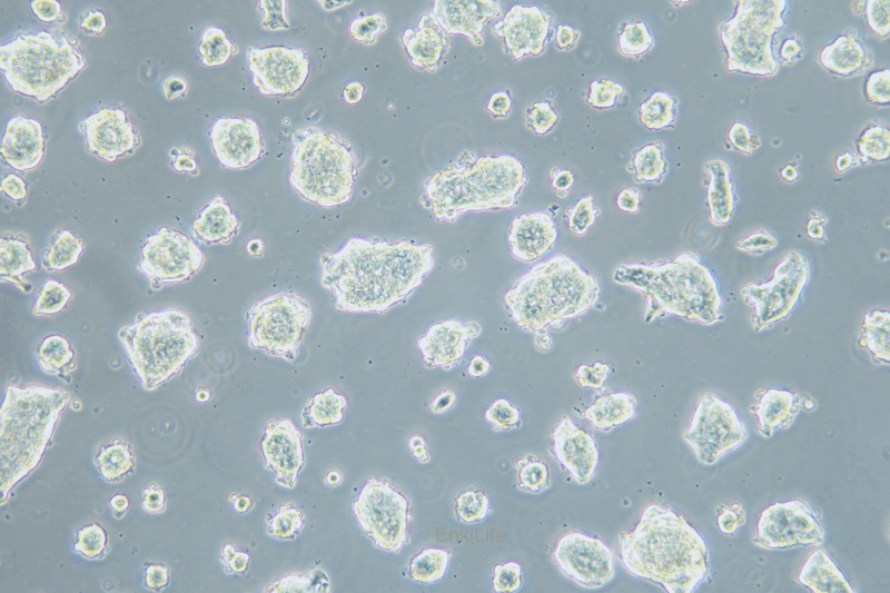人经典小细胞肺癌细胞NCI-H1688(STR鉴定) | EnkiLife恩玑生命