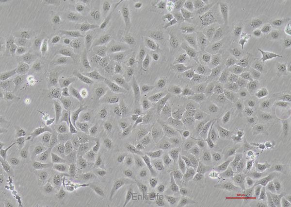 人卵巢癌细胞Skov3(STR鉴定) | EnkiLife恩玑生命