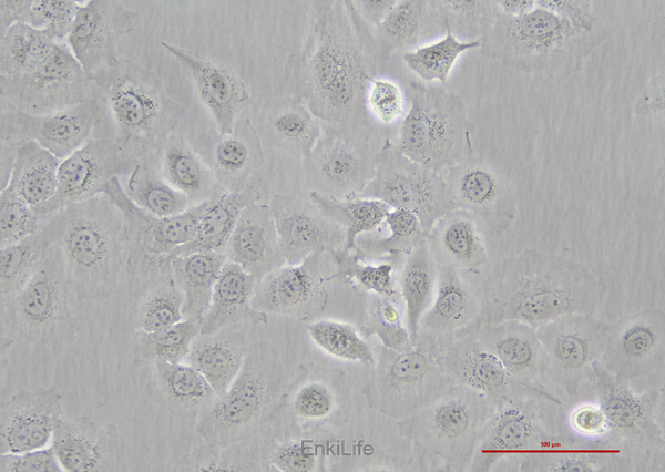 人卵巢癌细胞Skov3(STR鉴定) | EnkiLife恩玑生命