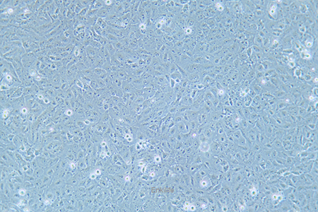 人卵巢癌腺癌细胞OVCAR-8(STR鉴定) | EnkiLife恩玑生命