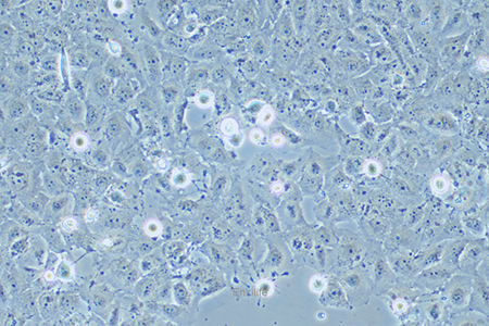 人卵巢癌腺癌细胞OVCAR-8(STR鉴定) | EnkiLife恩玑生命