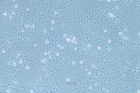 人卵巢癌腺癌细胞OVCAR-8(STR鉴定) | EnkiLife恩玑生命