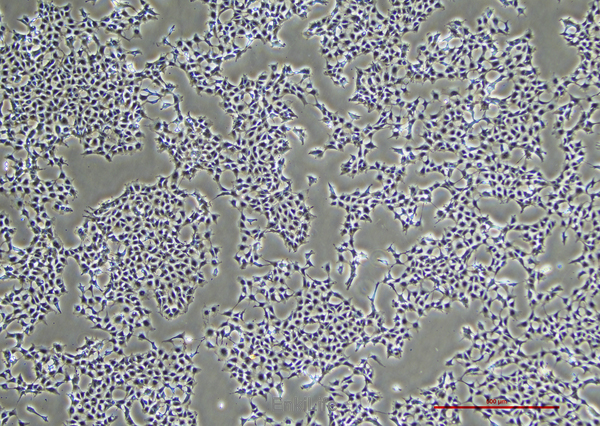 人卵巢畸胎瘤细胞PA-1(STR鉴定) | EnkiLife恩玑生命