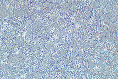 人卵巢透明细胞癌细胞ES-2(STR鉴定) | EnkiLife恩玑生命