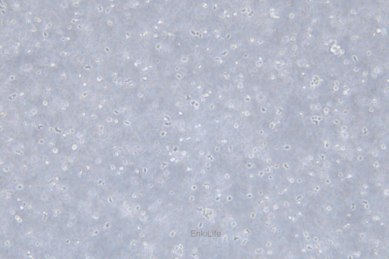 人慢性B细胞白血病细胞MEC-1(STR鉴定) | EnkiLife恩玑生命