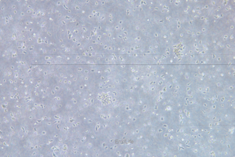 人慢性B细胞白血病细胞MEC-1(STR鉴定) | EnkiLife恩玑生命