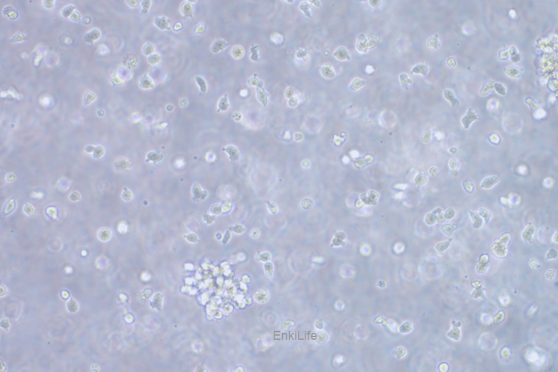 人慢性B细胞白血病细胞MEC-1(STR鉴定) | EnkiLife恩玑生命