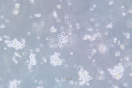 人弥漫大B细胞淋巴瘤细胞OCI-LY3(STR鉴定) | EnkiLife恩玑生命