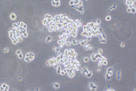 人弥漫大B细胞淋巴瘤细胞OCI-LY3(STR鉴定) | EnkiLife恩玑生命