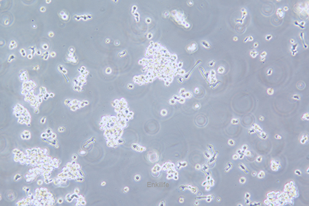 人弥漫大B细胞淋巴瘤细胞OCI-LY3(STR鉴定) | EnkiLife恩玑生命
