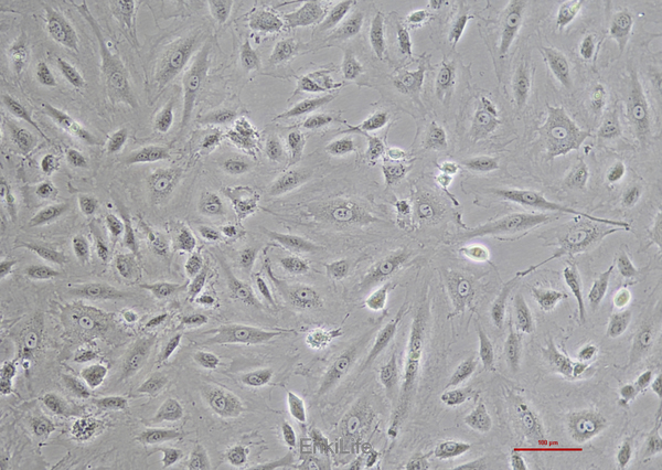 人脐静脉血管内皮细胞 HUVEC(免疫荧光鉴定) | EnkiLife恩玑生命