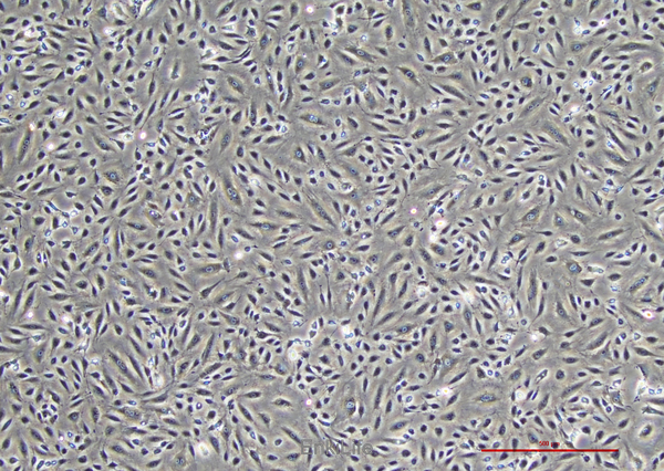 人脐静脉血管内皮细胞 HUVEC(免疫荧光鉴定) | EnkiLife恩玑生命