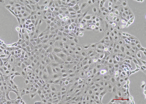 人前列腺癌细胞DU145(STR鉴定) | EnkiLife恩玑生命