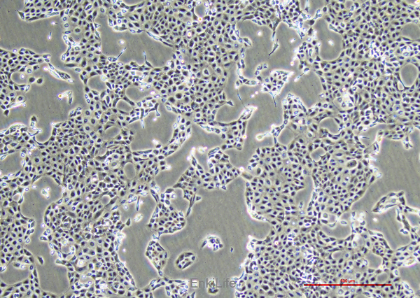 人前列腺癌细胞DU145(STR鉴定) | EnkiLife恩玑生命