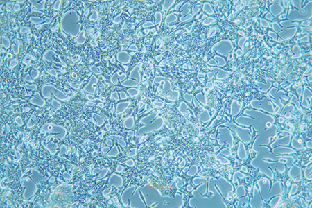 人前列腺癌细胞LNCaP(STR鉴定) | EnkiLife恩玑生命