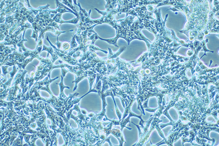 人前列腺癌细胞LNCaP(STR鉴定) | EnkiLife恩玑生命