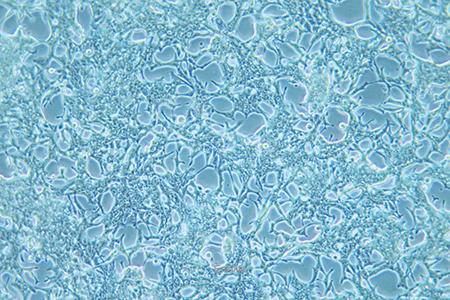 人前列腺癌细胞LNCaP(STR鉴定) | EnkiLife恩玑生命