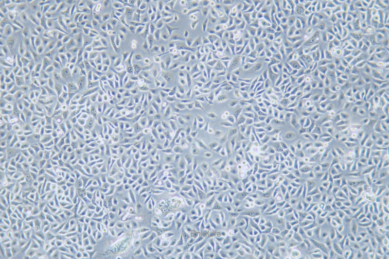 人前列腺正常细胞RWPE-2(STR鉴定) | EnkiLife恩玑生命
