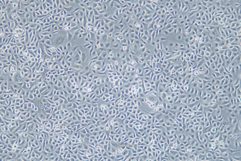 人前列腺正常细胞RWPE-2(STR鉴定) | EnkiLife恩玑生命