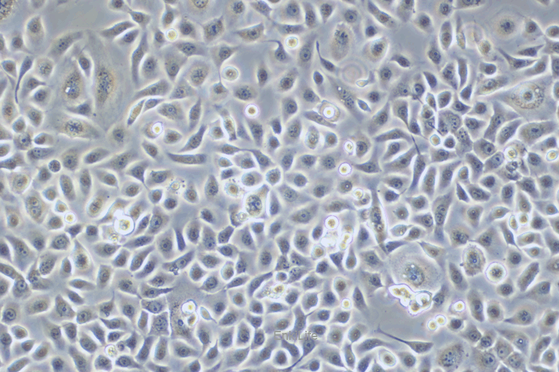 人前列腺正常细胞RWPE-2(STR鉴定) | EnkiLife恩玑生命