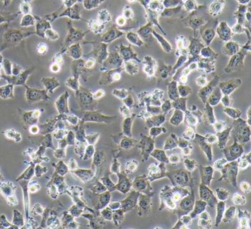 人侵袭性脉络膜黑色素瘤细胞MUM2B(STR鉴定) | EnkiLife恩玑生命