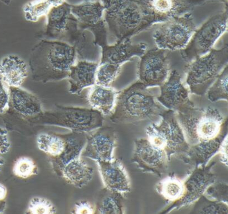 人侵袭性脉络膜黑色素瘤细胞MUM2B(STR鉴定) | EnkiLife恩玑生命