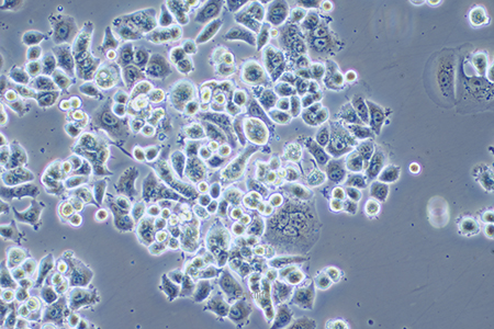 人乳腺癌细胞AU565(STR鉴定) | EnkiLife恩玑生命